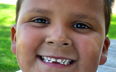 A young boy smiling with his missing teeth