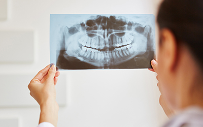 Woman looking at a dental x-ray